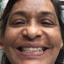 Our Work - DR SAMINA KATHAWALA DDS - CUTE SMILE DENTIST Hackensack NJ